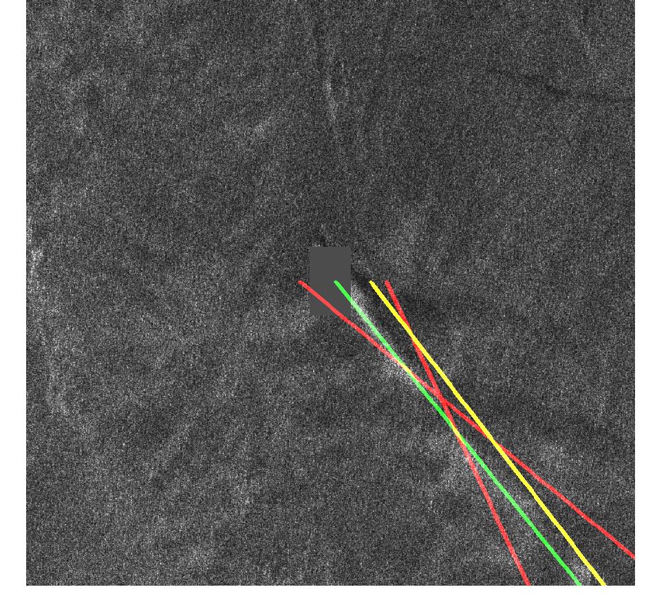 Figure 35